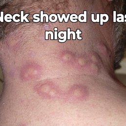 This is my brother-in-law's neck This is my brother-in-law's neck