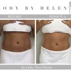 Body Contouring - Smaller waist in just 2 weeks