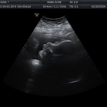 The Baby Connection - Diagnostic Imaging Near Me - Sacramento, California The Baby Connection - Diagnostic Imaging Near Me - Sacramento, California