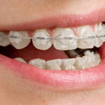 Sherman Orthodontics - 3D Imaging - Orthodontists Near Me - Pittsburgh, Pennsylvania Sherman Orthodontics - 3D Imaging - Orthodontists Near Me - Pittsburgh, Pennsylvania