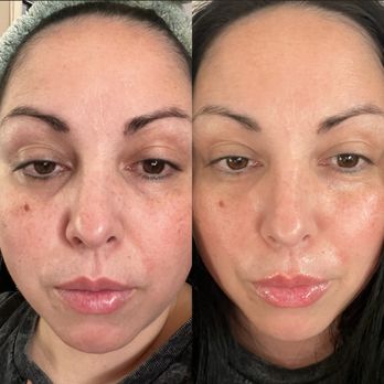 The Ayurveda Experience - Before and After. First time use - Cosmetics & Beauty Supply Near Me - Torrance, California The Ayurveda Experience - Before and After. First time use - Cosmetics & Beauty Supply Near Me - Torrance, California
