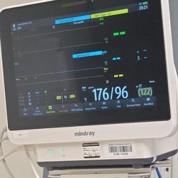 Abrazo Surprise Hospital - This was my blood pressure after sitting in the yard for about an hour and a 1/2. It had finally come down non scary numbers