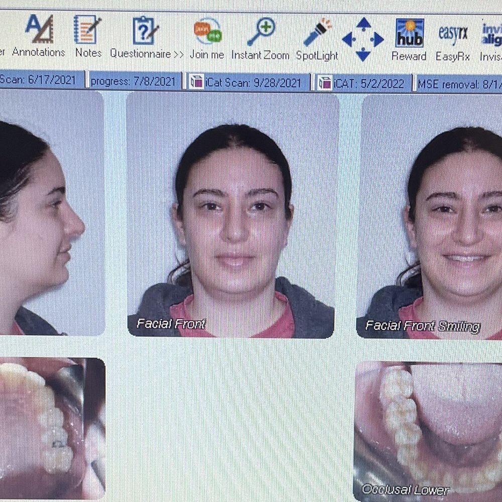 Invisalign Dentist Near Me Inwood, NY