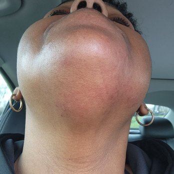 Follicle Free Electrology - Underneath - 3/2/2026 update - Laser Hair Removal Near Me - Concord, North Carolina Follicle Free Electrology - Underneath - 3/2/2026 update - Laser Hair Removal Near Me - Concord, North Carolina