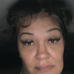 Truth General Dentistry - I went from pretty to ugly my face is clearly deformed