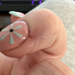 2 days later. My toes are also infected now from pedicure. Just stay away from this place. 2 days later. My toes are also infected now from pedicure. Just stay away from this place.