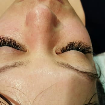 Skin Solutions - After - Skin Care Near Me - Corona, California Skin Solutions - After - Skin Care Near Me - Corona, California