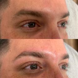 Dérmica MedEsthetics - Men's brow shape (brow wax) before and after.
any redness resulting from waxing usually subsides within 20 minutes.