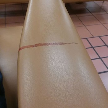 Biomat USA - Dried old blood from a previous donor on the arm rest - Blood & Plasma Donation Centers Near Me - Austin, Texas