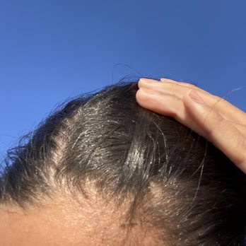 Headed Your Way - Burnt scalp - Hair Salons Near Me - Lakewood, California Headed Your Way - Burnt scalp - Hair Salons Near Me - Lakewood, California