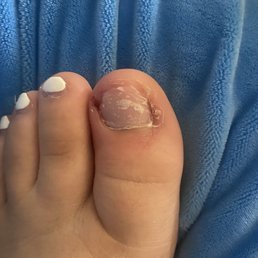 My toes are infected after coming here! My toes are infected after coming here!