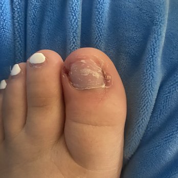 Vanity Nails & Spa - My toes are infected after coming here! - Nail Salons Near Me - Perris, California Vanity Nails & Spa - My toes are infected after coming here! - Nail Salons Near Me - Perris, California