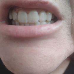 Indiana University School of Dentistry