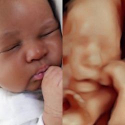 Beverly Hills Ultrasound - 3D,4D ultrasound