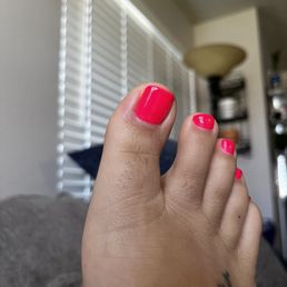 Possible toe infection due to incorrect practices!