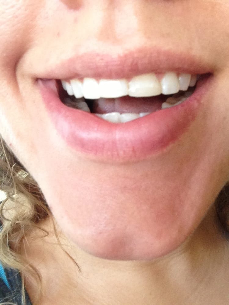 MIRROR IMAGE DENTISTRY Updated September 2024 2140 Bispham Rd