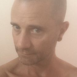 After Scalp Micro Pigmentation at Scalp Society in Honolulu