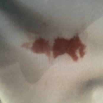Rinse - Blood stains on clothes when returned. - Dry Cleaning Near Me - San Francisco, California