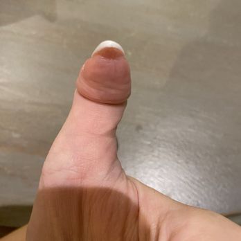 Fiore Nail Bar - Thumb nail thickness and uneven - Nail Salons Near Me - Flower Mound, Texas Fiore Nail Bar - Thumb nail thickness and uneven - Nail Salons Near Me - Flower Mound, Texas