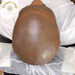 Savaya Salon Barbershop - Scalp Micro pigmentation SMP
Hair Tattoo