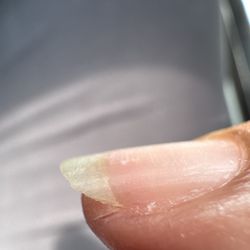 California Nails - A cut near my nail.