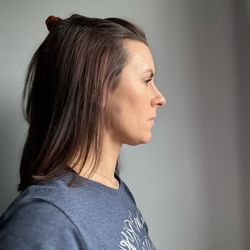 National Hair Loss Medical Aesthetics - March 2024