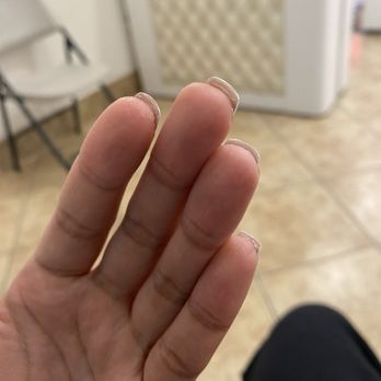 Top Nails - Pedicure results (behind mg natural nails) - Pizza Near Me - Bakersfield, California Top Nails - Pedicure results (behind mg natural nails) - Pizza Near Me - Bakersfield, California