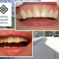 Capitol Square Dental