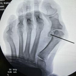Capital Foot & Ankle Surgeons of Austin