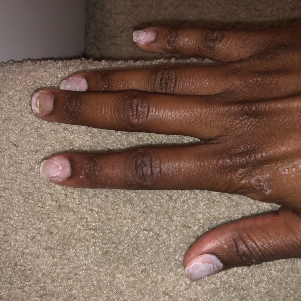Grand Nail Bar - End result of "soaked off" nails. - Nail Salons Near Me - DeSoto, Texas Grand Nail Bar - End result of "soaked off" nails. - Nail Salons Near Me - DeSoto, Texas