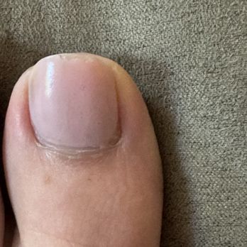 Shinee Beauty Salon - 1 week later - Nail Salons Near Me - Brookline, Massachusetts