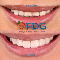 Smile Makeover by Dr. Sanaz Shahbandi