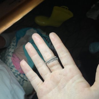 Baymont by Wyndham St. Ignace Lakefront - singe under my middle finger and ring - Hotels Near Me - Saint Ignace, Michigan