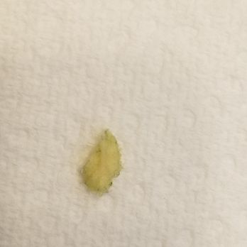 Tropical Smoothie Cafe - Hard unknown object found in one of my Island Green smoothies, June 13, 2020. - Juice Bars & Smoothies Near Me - Evans, Georgia