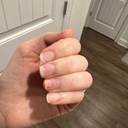 damaged nail from popping off acrylic damaged nail from popping off acrylic
