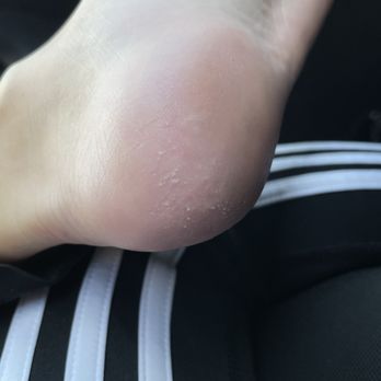 Get Nailed - The heels of my feet were burning and so sensitive until day 3 - Nail Salons Near Me - Las Vegas, Nevada