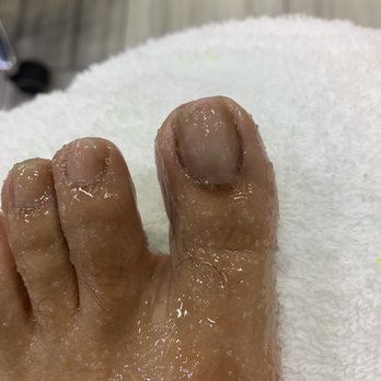 Laque Nail Bar - This is when the exposed hyponychium from the manicurists mistake started to burn! - Nail Salons Near Me - North Hollywood, California