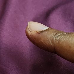 Modern Nails & Spas - Cut finger