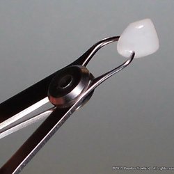 Preston Rowland, DDS - This is the lens thin restorations, that we used on Amine. Lumineer veneers are very minimal preparation of the teeth.
