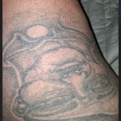 Sonora Quest Laboratories - Richard's Hitler tattoo