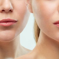 Ultra Smooth Skin
