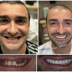 Elk Grove Smile Center: Vishal Advani, DDS