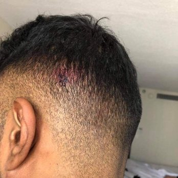 Backyard - Dallas - This was one of the many injuries. - New American Near Me - Dallas, Texas