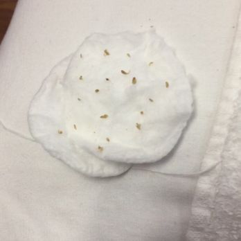 Newrain Eyebrow Threading - These are all the blackheads she removed from my face. It's Nasty but my skin is so smooth right now. - Skin Care Near Me - Arlington, Texas