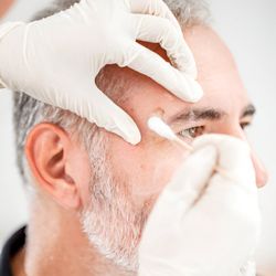 ACS Dermatology - Skin Tag & Mole Removal