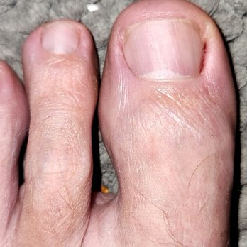 Cartier Nails & Spa  - Male clients prefer straight across cut. Never asked preference. Ingrown toenails are an issue. Toe already bleeding after pedicure. - Nail Salons Near Me - Scottsdale, Arizona
