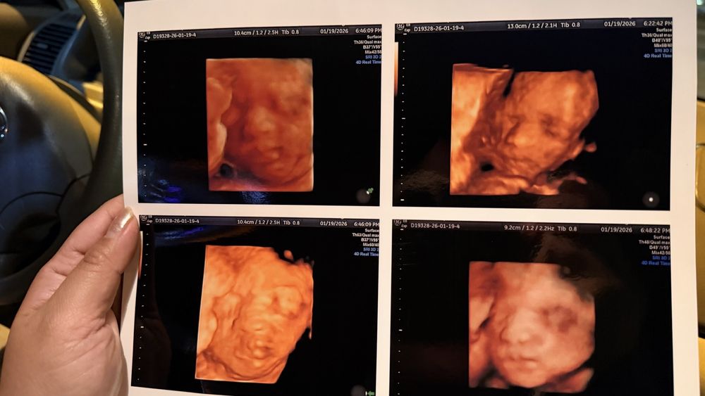 Heavenly 3D 4D Ultrasounds