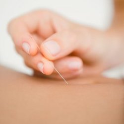 Allied Pain & Spine Institute - Acupuncture