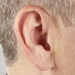 OC Pro Hearing