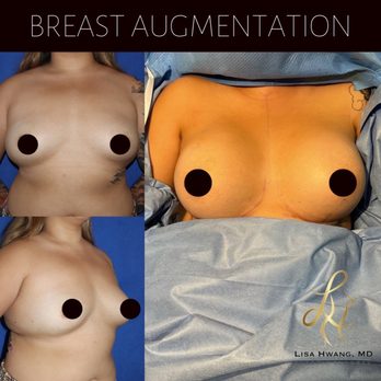 Lisa Hwang, MD - Plastic Surgeons Near Me - Campbell, California Lisa Hwang, MD - Plastic Surgeons Near Me - Campbell, California